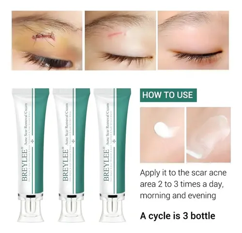 .ok Crema Breylee Elimina Estrías Cicatrices .ko