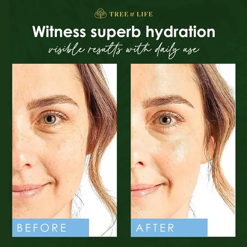 Serum Acido Hyaluronico Tree Life. Made In Usa. 60ml Premium