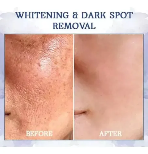 Nueva Crema Reafirmante Y Reductora De Arrugas Fubsta Tig