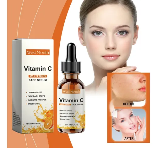 Sérum Facial Para La Piel Con Vitamina C De West Month