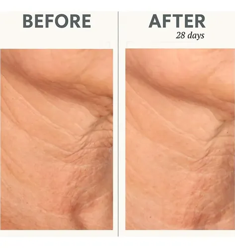 Crema Facial Reafirmante Correc-chin In-tense 1.7 Oz
