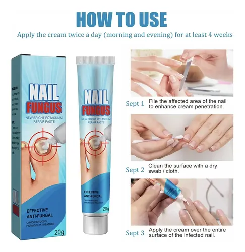 Crema Anti Hongos De Uñas Ataca Onicomicosis Pies Salud Fragancia Herbal