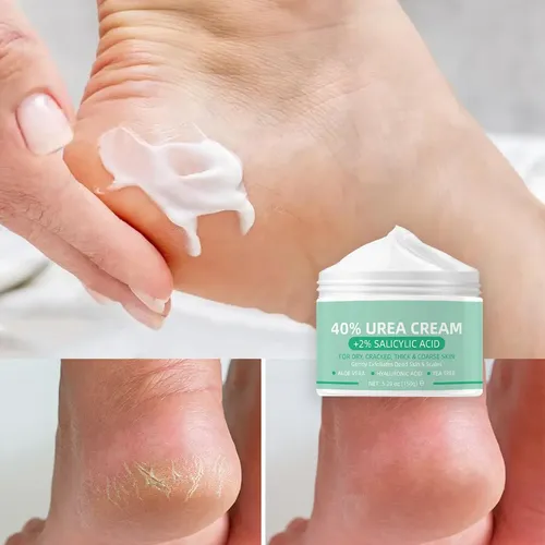 Crema De Urea 40% + 2% Ácido Salicílico Para Pies Secos Pq