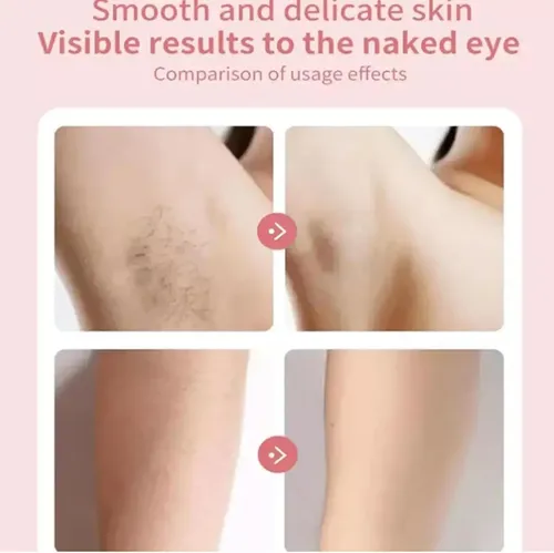 Depiladora Facial Pluxy Epil Pro 3.0 Para Mujer, Depilación