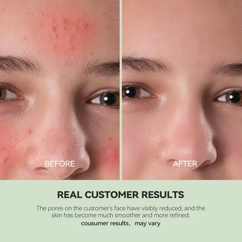 Mascarilla Limpiadora De Arcilla Wnp Duo Con Niacinamida Y Á