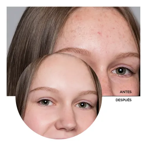 Revox B77 Zitcare Gel Limpieza Facial Aha- Bha- Pha 250ml 3c