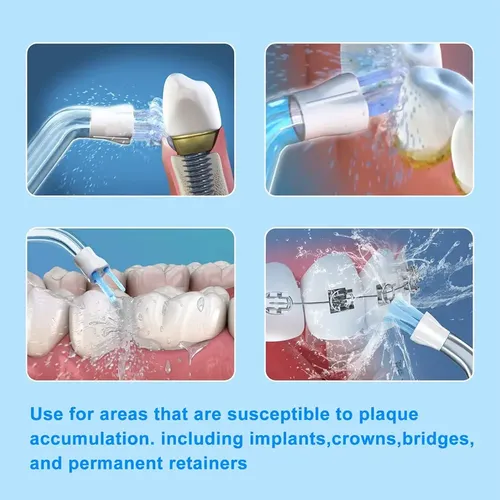Tendencia Repuestos Boquilla For Irrigador Dental Agua ..