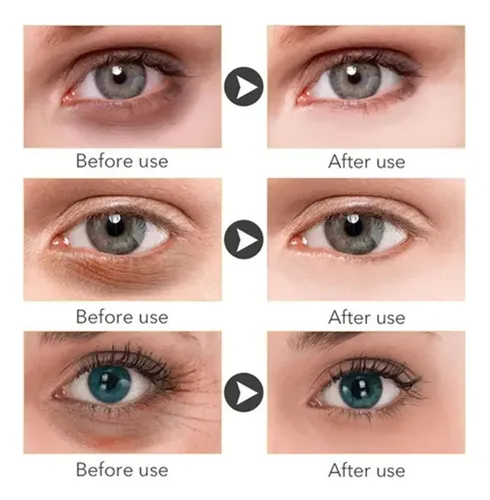 Parches Para Ojos Ojeras Colágeno Oro Arrugas 100 Pares Mz22
