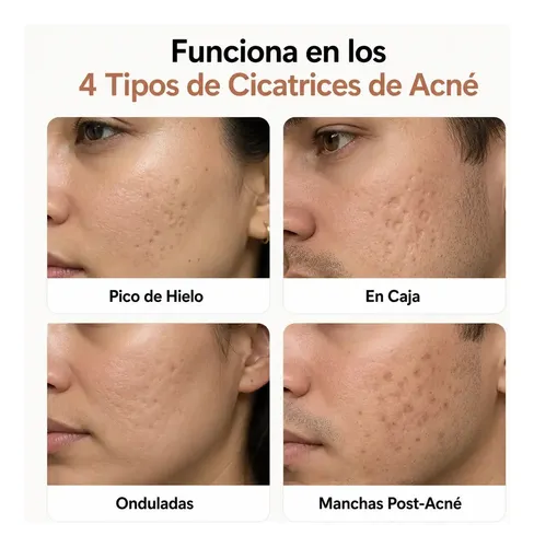 Stick Reparador De Cicatrices Silicona Para Cuidado Acne