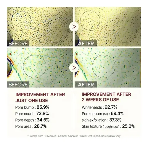 Sdfs Exfoliante Dr. Melaxin: Cuerpo, Eliminador De Werw