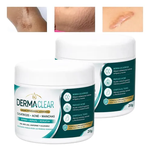 Crema Antiimperfecciones Varices Estrías 20 G Acne Manchas