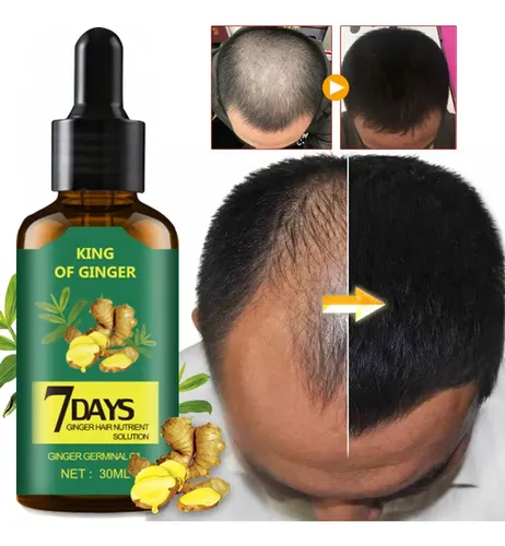 Aceite De Jengibre King Of Ginger 30ml Anticaída