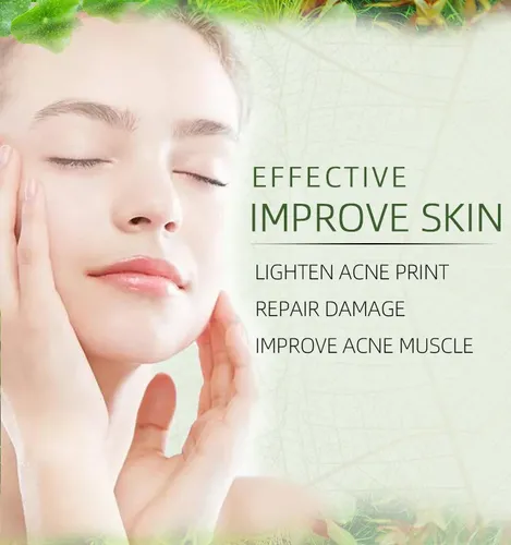2026 2 Crema Herbal Antiacné Controla Granos -pls