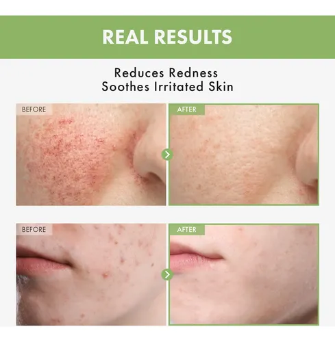 Heartleaf Face Toner With 970,200ppm Heartleaf Water,
