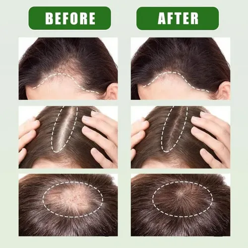 Aceite De Batana 100% Crudo Para El Crecimiento Del Cabello: