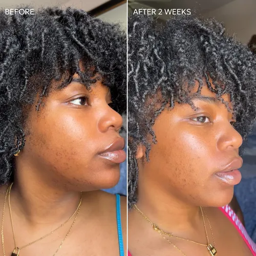 Fycrema Correctora De Manchas Oscuras Dermisa Skin Fade Con