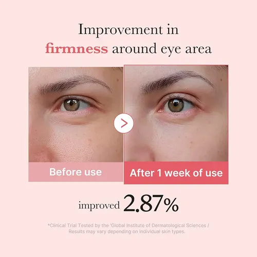 Medicube Sérum Ojos Pdrn Péptidos Antiarrugas 30ml Coreano
