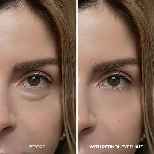 Dr.melaxin, Eyephalt, Retinol Eyebag Cream, 10 G Todo Tipo De Piel Día/noche