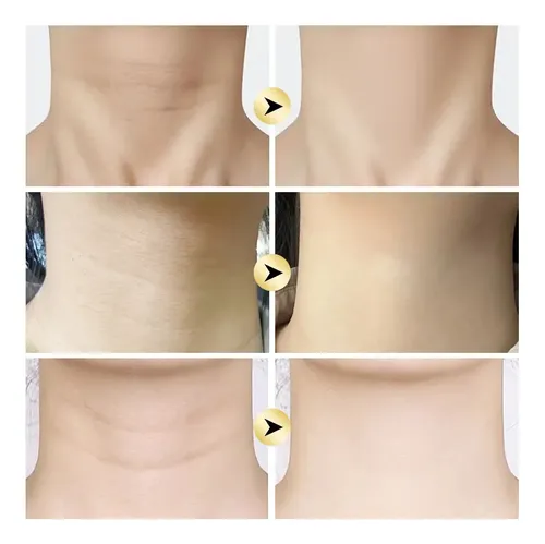 Premium Ab. Crema Para Cuello, Hidratante Y Reafirmante, Eas