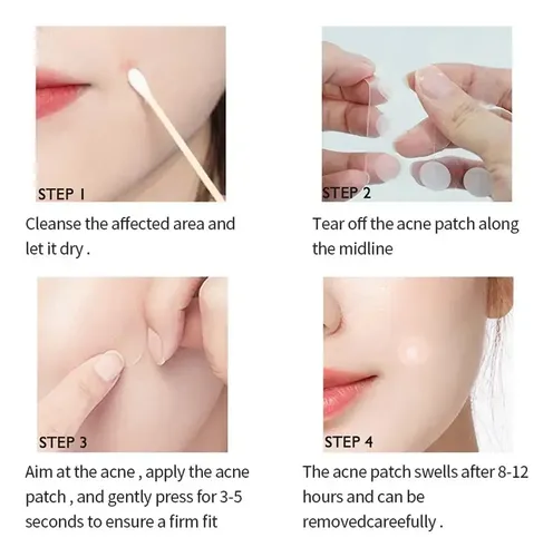 120 Parches Invisibles Para Eliminar El Acné Pimple Ii