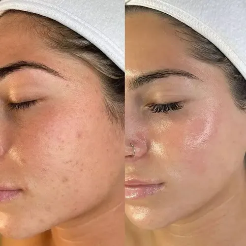 Rutina Skincare De Noche Completo Cuidado Facial En 5 Pasos