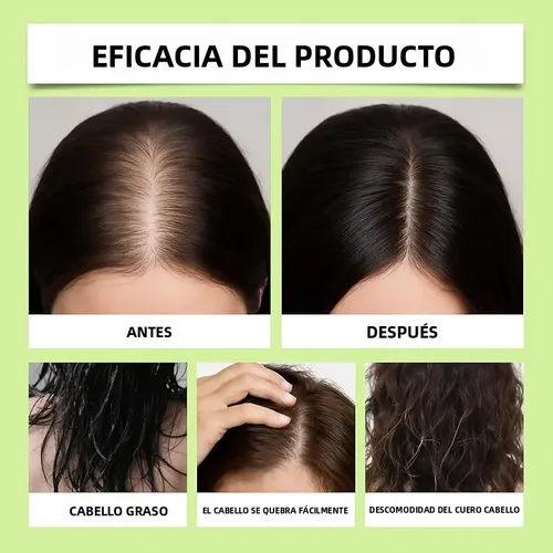 Suero Microagujas Crecimiento Cabello + Biotina – 30 Ml