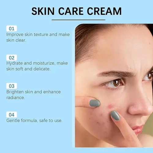 Crema Facial Para El Acné Con Un 20% De Ácido Azelaico,