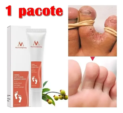 Crema Fitoterapia Para Tartas Y Antihongos