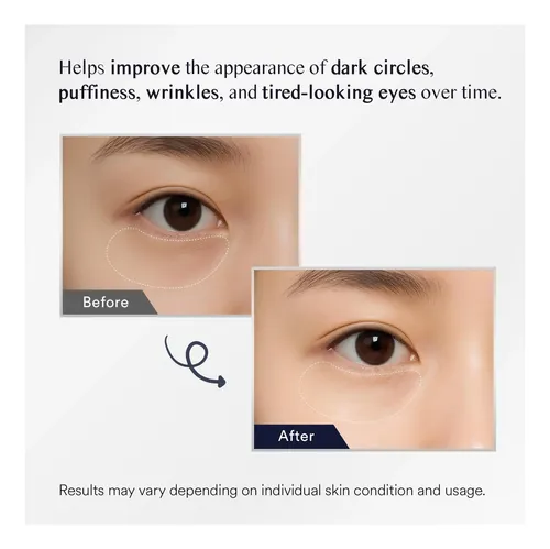 Parches De Gel Para Ojeras, Hidrogel, 30 Pares, Efecto Frío