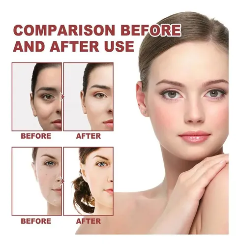 3 Sets Parches De Colágeno Collagen Film Acido Hialuronico