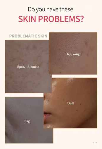 Txa+niacinm Brighen Seru For Dul Skin  Dark Spot Reduc 30ml