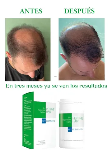 Peptine Hair Peptona Caída Cabello Bio-regenerador Capilar
