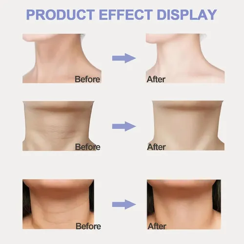 Crema Reafirmante Para Cuello, Crema Para Tensar El Cuello