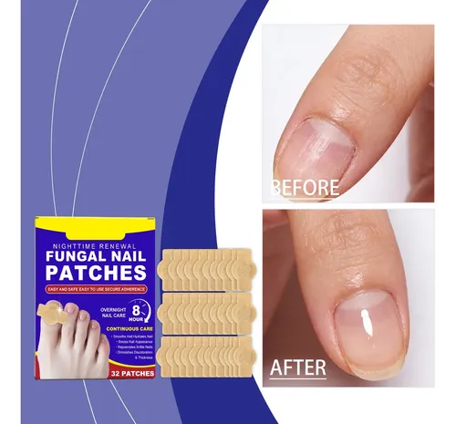 ¿las Pegatinas Para El Cuidado De Las Uñas Son Transpirables