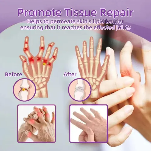 Gel De Masaje Calmante Para Aliviar El Dolor Y La Artritis C