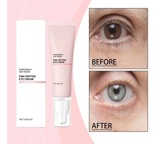 Crema Para Ojos Reduce Ojeras Y Bolsas