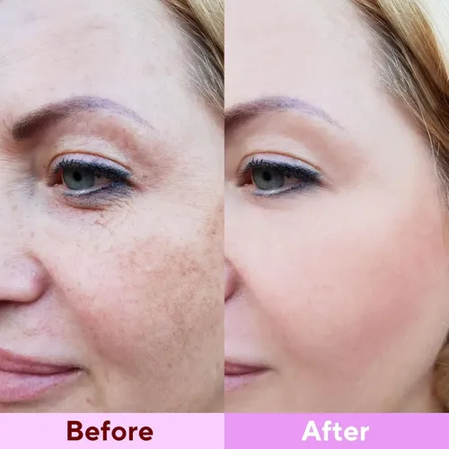 Mascarilla De Colágeno