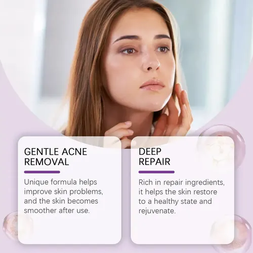 Crema Facial Hidratante Suave Para El Tratamiento Del Acné C