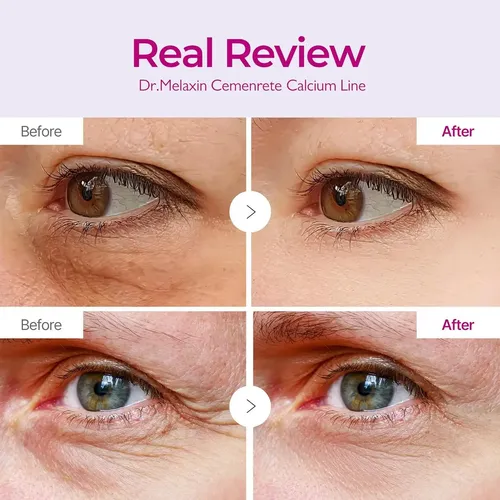 Parche Para Ojos Dr. Melaxin Cemenrete, Volumen De Calcio, 6