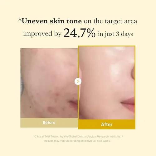 Medicube Mascarilla De Cúrcuma Y Ácido Kójico, Piel Luminos