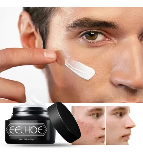 Crema Bb Eelhoe Para Hombre: Sin Aceite, Difumina Los Poros