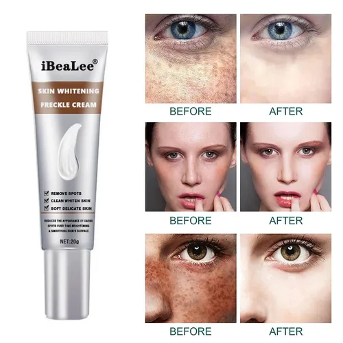 Crema Hidratante Para Manchas Que Se Decoloran, Nutre Y Mejo Todo Tipo De Piel