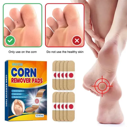 Cuidado De Los Pies De Verruga Espinosa Con Crema De Ojos De