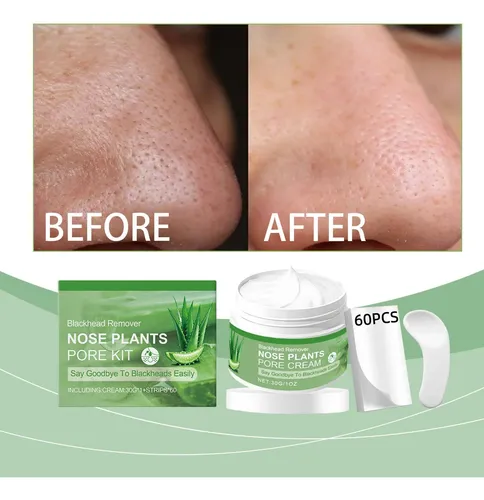 Mascarilla Nasal Removible, Set Nasal Para Limpieza No Aprez