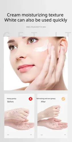 Crema Hidratante De Niacinamida, Corrector De Aceite, Elimin