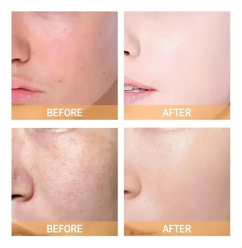 -tónico Exfoliante Original Con Ácido Glicólico Al 7 240 Ml[