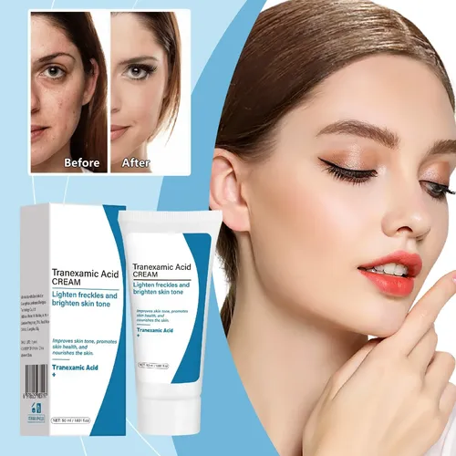 Crema Hidratante Ligera Para Manchas De Ácidos Tranexámicos
