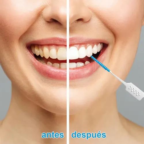 Xiaoyii 400 Mini Cepillos Hilo Dental Silicona Xiaoyii