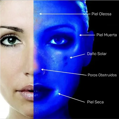 Luz De Wood Portátil Facial Usb
