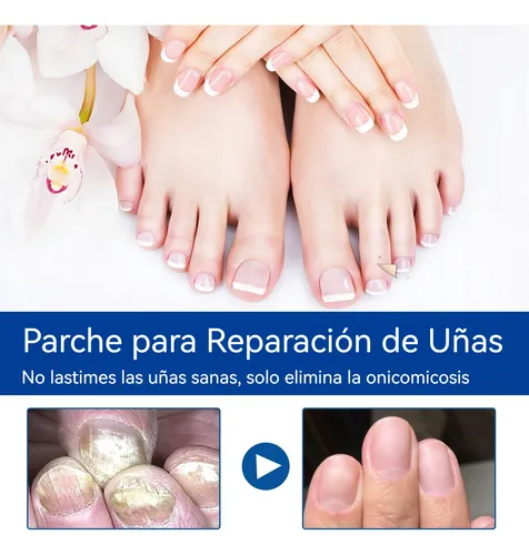 Parche Para El Cuidado De Las Uñas, Suave Y Limpio, Transpir 60 Patches As Described
